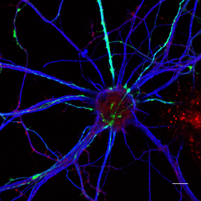 Des neurones en culture vus au microscope confocal